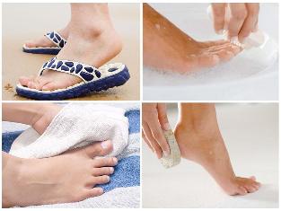 fungus foot skin-prevention