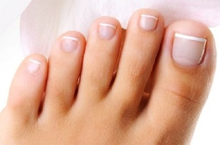nail fungus on your feet
